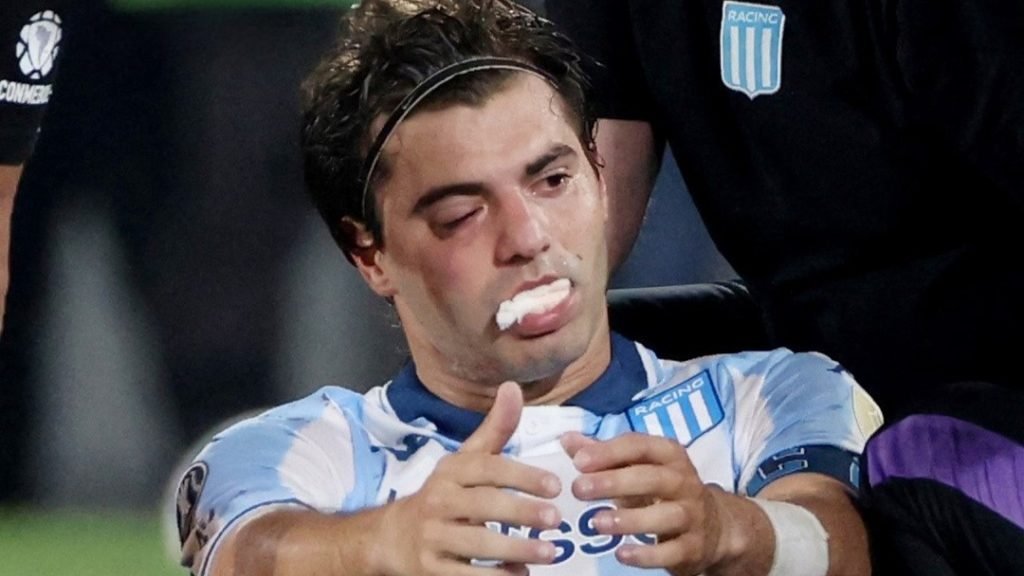 Sosa fue operado y se perderá el partido de vuelta por Copa Libertadores ante Flamengo