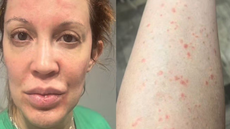 Miriam Lanzoni reflexion&oacute; sobre su salud: "Dorm&iacute;a envuelta en papel film"